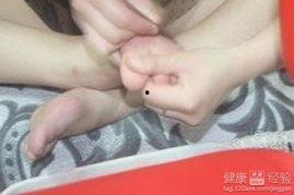 吃瓜小熊甲沟炎,一场甜蜜的“痛”之旅